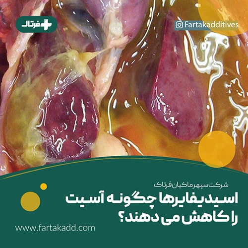 بیماری آسیت